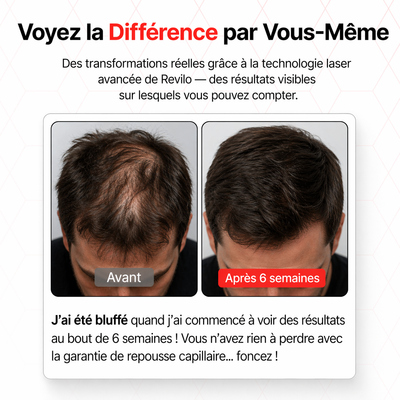 Casquette laser XL haut de gamme pour une couverture maximale