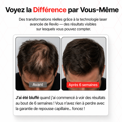 Casquette laser XL haut de gamme pour une couverture maximale