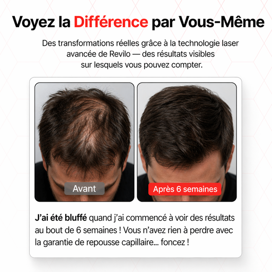 Casquette laser XL haut de gamme pour une couverture maximale